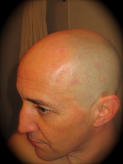 Name:  111229_head_shave_after_3.jpg
Views: 8187
Size:  17.2 KB