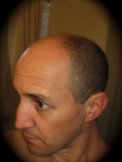 Name:  111229_head_shave_before_2.jpg
Views: 4575
Size:  17.8 KB