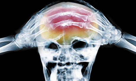 Name:  X-ray-of-headache-001.jpg
Views: 204
Size:  26.6 KB