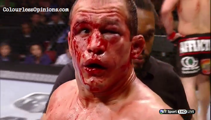 Name:  Junior Dos Santos blood covered injured face in UFC 166 versus Velasquez.png
Views: 2015
Size:  392.6 KB